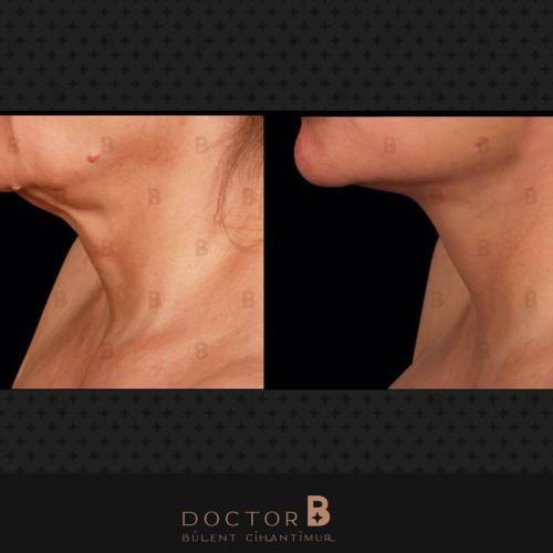 صور قبل وبعد لمرضانا 9